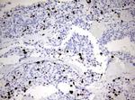 KI67 Antibody in Immunohistochemistry (Paraffin) (IHC (P))