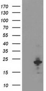 KIAA0495 Antibody in Western Blot (WB)