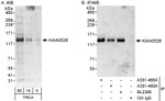 KIAA0528 Antibody in Western Blot (WB)