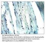 KIF14 Antibody in Immunohistochemistry (IHC)