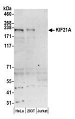 KIF21A Antibody in Western Blot (WB)