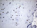 KLF5 Antibody in Immunohistochemistry (Paraffin) (IHC (P))