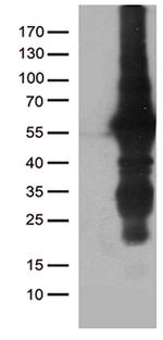 KLF5 Antibody in Western Blot (WB)