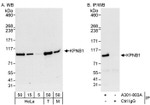 KPNB1 Antibody in Western Blot (WB)