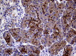 KRT18 Antibody in Immunohistochemistry (Paraffin) (IHC (P))