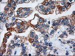 KRT18 Antibody in Immunohistochemistry (Paraffin) (IHC (P))