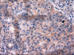 KRT18 Antibody in Immunohistochemistry (Paraffin) (IHC (P))