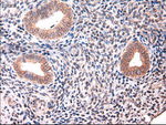 KRT18 Antibody in Immunohistochemistry (Paraffin) (IHC (P))