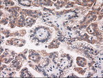 KRT18 Antibody in Immunohistochemistry (Paraffin) (IHC (P))