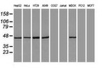 KRT18 Antibody in Western Blot (WB)