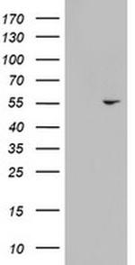 KRT24 Antibody in Western Blot (WB)