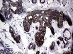 KRT7 Antibody in Immunohistochemistry (Paraffin) (IHC (P))