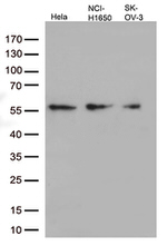 KRT7 Antibody in Western Blot (WB)