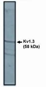 KV1.3 (KCNA3) Antibody in Western Blot (WB)