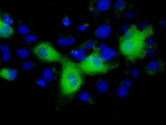 L1CAM Antibody in Immunocytochemistry (ICC/IF)