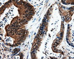 L1CAM Antibody in Immunohistochemistry (Paraffin) (IHC (P))