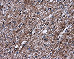 L1CAM Antibody in Immunohistochemistry (Paraffin) (IHC (P))