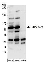 LAP2 beta/TMPO Antibody in Western Blot (WB)