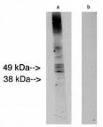 Lass2 Antibody in Western Blot (WB)