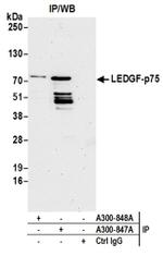 LEDGF/p75 Antibody in Immunoprecipitation (IP)