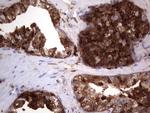 LGALS3 Antibody in Immunohistochemistry (Paraffin) (IHC (P))