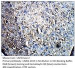 LIM kinase 2 Antibody in Immunohistochemistry (IHC)