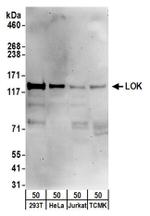 LOK Antibody in Western Blot (WB)