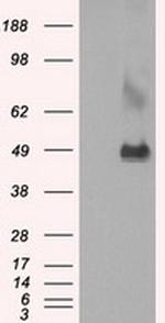 LOX Antibody in Western Blot (WB)