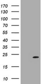 LZIC Antibody in Western Blot (WB)