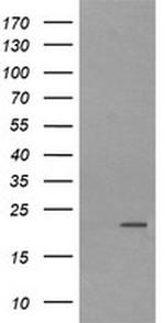 LZIC Antibody in Western Blot (WB)