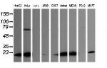 LZIC Antibody in Western Blot (WB)