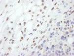 Lamin-A Antibody in Immunohistochemistry (IHC)