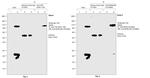 TAP Tag Antibody in Immunoprecipitation (IP)