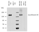 NEFM Antibody in Western Blot (WB)