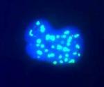 Fibrillarin Antibody in Immunocytochemistry (ICC/IF)