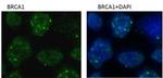 BRCA1 Antibody in Immunocytochemistry (ICC/IF)