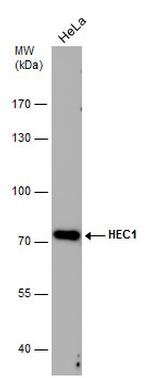 HEC1 Antibody in Western Blot (WB)