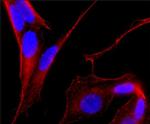 MAP2 Antibody in Immunocytochemistry (ICC/IF)