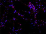 MAP2 Antibody in Immunocytochemistry (ICC/IF)