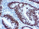 MLH1 Antibody in Immunohistochemistry (Paraffin) (IHC (P))