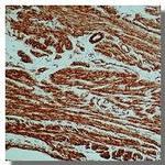 Alpha-Smooth Muscle Actin Antibody in Immunohistochemistry (Paraffin) (IHC (P))