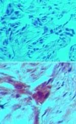 D4-GDI Antibody in Immunohistochemistry (Paraffin) (IHC (P))