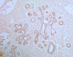 APIP Antibody in Immunohistochemistry (Paraffin) (IHC (P))