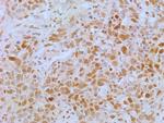 APIP Antibody in Immunohistochemistry (Paraffin) (IHC (P))