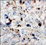 WT1 Antibody in Immunohistochemistry (Paraffin) (IHC (P))