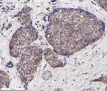 EpCAM Antibody in Immunohistochemistry (Paraffin) (IHC (P))