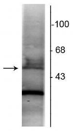 RARA Antibody in Western Blot (WB)