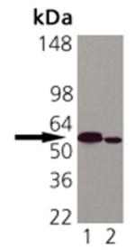 Calreticulin Antibody in Western Blot (WB)