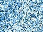 Cytomegalovirus IE + Early Antigen Antibody in Immunohistochemistry (IHC)