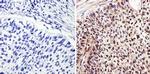 c-Myc Antibody in Immunohistochemistry (Paraffin) (IHC (P))